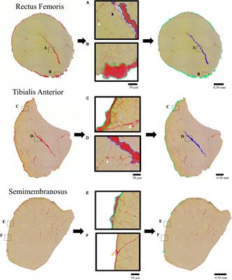 Intramuscular Anatomy Drives Collagen Content Variation Within and Between Muscles